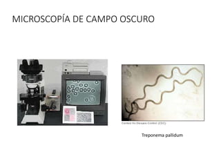 MICROSCOPÍA DE CAMPO OSCURO
Treponema pallidum
 