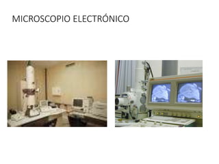 MICROSCOPIO ELECTRÓNICO
 