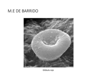 M.E DE BARRIDO
Glóbulo rojo
 