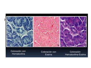 Hematoxilina-Eosina
 