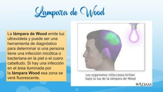 Lampara de Wood
La lámpara de Wood emite luz
ultravioleta y puede ser una
herramienta de diagnóstico
para determinar si una persona
tiene una infección micótica o
bacteriana en la piel o el cuero
cabelludo. Si hay una infección
en el área iluminada por
la lámpara Wood esa zona se
verá fluorescente.
 
