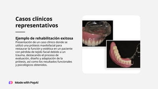 Casos clínicos
representativos
Ejemplo de rehabilitación exitosa
Presentación de un caso clínico donde se
utilizó una prótesis maxilofacial para
restaurar la función y estética en un paciente
con pérdida de tejido facial debido a un
trauma, destacando el proceso de
evaluación, diseño y adaptación de la
prótesis, así como los resultados funcionales
y psicológicos obtenidos.
 