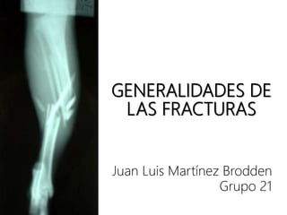 GENERALIDADES DE
LAS FRACTURAS
Juan Luis Martínez Brodden
Grupo 21
 