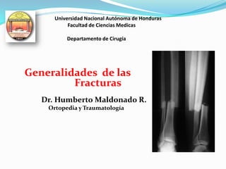 Universidad Nacional Autónoma de Honduras
Facultad de Ciencias Medicas
Departamento de Cirugía
Generalidades de las
Fracturas
Dr. Humberto Maldonado R.
Ortopedia y Traumatología
 
