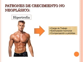 PATRONES DE CRECIMIENTO NO NEOPLÁSICO: Hipertrofia Carga de Trabajo Estimulación hormonal Compensación a pérdidas. 