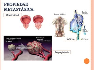 PROPIEDAD METASTÁSICA: Angiogénesis Linfática Continuidad 