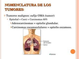 NOMENCLATURA DE LOS TUMORES : Tumores malignos: sufijo OMA (tumor): Epitelial = Carci = Carcinomas 80%  Adenocarcinomas = epitelio glandular. Carcinomas escamocelulares = epitelio escamoso. 