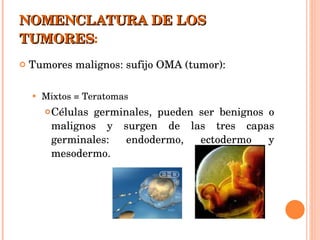 NOMENCLATURA DE LOS TUMORES : Tumores malignos: sufijo OMA (tumor): Mixtos = Teratomas Células germinales, pueden ser benignos o malignos y surgen de las tres capas germinales: endodermo, ectodermo y mesodermo. 