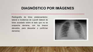 DIAGNÓSTICO POR IMÁGENES
Radiografía de tórax pósteroanterior,
lateral e incidencia de Laurell (lateral de
tórax acostado sobre el lado que no se
sospecha derrame, con los brazos
elevados, para descartar o confirmar
derrame).
 