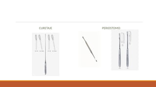 Comprehensive Overview of Surgical Instruments: Types, Uses, and ...