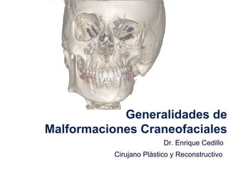 Generalidades de
Malformaciones Craneofaciales
Dr. Enrique Cedillo
Cirujano Plástico y Reconstructivo
 