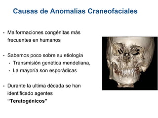 • Malformaciones congénitas más
frecuentes en humanos
• Sabemos poco sobre su etiología
• Transmisión genética mendeliana,
• La mayoría son esporádicas
• Durante la ultima década se han
identificado agentes
“Teratogénicos”
Causas de Anomalias Craneofaciales
 