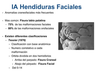 • Anomalias craneofaciales más frecuentes
• Mas común: Fisura labio palatina
• 75% de las malformaciones faciales
• 80% de las malformaciones orofaciales
• Existen diferentes clasificaciones
• Tessier (1976)
• Clasificación con base anatómica
• Numero correlativo a cada
malformación
• Orbita dividida en dos hemisferios
• Arriba del parpado: Fisura Craneal
• Abajo del párpado: Fisura Facial
• Del 0-14
IA Hendiduras Faciales
 