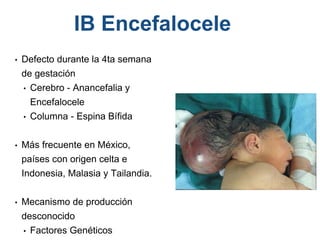 • Defecto durante la 4ta semana
de gestación
• Cerebro - Anancefalia y
Encefalocele
• Columna - Espina Bífida
• Más frecuente en México,
países con origen celta e
Indonesia, Malasia y Tailandia.
• Mecanismo de producción
desconocido
• Factores Genéticos
IB Encefalocele
 