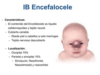 • Caracteristicas:
• El contenido del Encefalocele es líquido
cefalorraquídeo y tejido neural.
• Cubierta variable
• Desde piel a cabellos a solo meninges
• Tejido nervioso descubierto
• Localización:
• Occipital 75%
• Parietal y sincipital 15%
• Sincipucio: Nasofrontal,
Nasoetmoidal y nasoorbital
IB Encefalocele
 