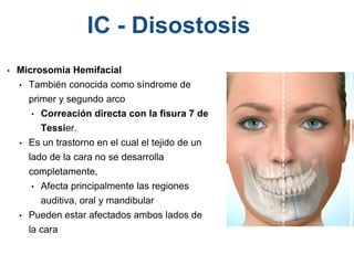 • Microsomia Hemifacial
• También conocida como síndrome de
primer y segundo arco
• Correación directa con la fisura 7 de
Tessier.
• Es un trastorno en el cual el tejido de un
lado de la cara no se desarrolla
completamente,
• Afecta principalmente las regiones
auditiva, oral y mandibular
• Pueden estar afectados ambos lados de
la cara
IC - Disostosis
 