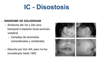 • SINDROME DE GOLDENHAR
• Síndrome del 1er y 2do arco
branquial o espectro óculo-auriculo-
vertebral
• Complejo de anomalías
craneofaciales y vertebrales.
• Descrito por Von Arlt, pero no fue
considerado hasta 1952
IC - Disostosis
 
