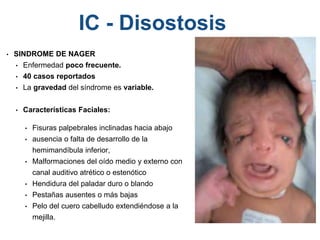 • SINDROME DE NAGER
• Enfermedad poco frecuente.
• 40 casos reportados
• La gravedad del síndrome es variable.
• Características Faciales:
• Fisuras palpebrales inclinadas hacia abajo
• ausencia o falta de desarrollo de la
hemimandíbula inferior,
• Malformaciones del oído medio y externo con
canal auditivo atrético o estenótico
• Hendidura del paladar duro o blando
• Pestañas ausentes o más bajas
• Pelo del cuero cabelludo extendiéndose a la
mejilla.
IC - Disostosis
 