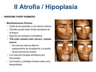 • SINDROME PARRY ROMBERG
• Manifestaciones Clínicas:
• Caída de las pestañas y una calvicie anterior
• También puede haber atrofia ipsolateral de
la lengua.
• Algunos pxs epilepsia contralateral
• Piel color castaño claro; Severo castaño
oscuro
• Se cree que esto se debe al
espesamiento de la epidermis y la atrofia
de las estructuras anexas.
• Los músculos faciales atrofiados pero
funcionales
• Los huesos y cartílagos faciales están poco
desarrollados
II Atrofia / Hipoplasia
 
