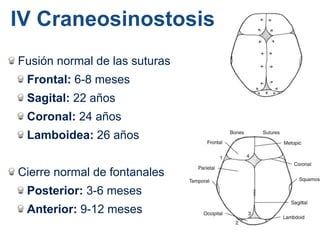 Fusión normal de las suturas
Frontal: 6-8 meses
Sagital: 22 años
Coronal: 24 años
Lamboidea: 26 años
Cierre normal de fontanales
Posterior: 3-6 meses
Anterior: 9-12 meses
IV Craneosinostosis
 