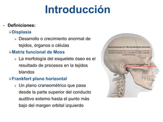 • Definiciones:
Displasia
Desarrollo o crecimiento anormal de
tejidos, órganos o células
Matriz funcional de Moss
La morfología del esqueleto óseo es el
resultado de procesos en la tejidos
blandos
Frankfort plano horizontal
Un plano craneométrico que pasa
desde la parte superior del conducto
auditivo externo hasta el punto más
bajo del margen orbital izquierdo
Introducción
 