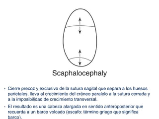 • Cierre precoz y exclusivo de la sutura sagital que separa a los huesos
parietales, lleva al crecimiento del cráneo paralelo a la sutura cerrada y
a la imposibilidad de crecimiento transversal.
• El resultado es una cabeza alargada en sentido anteroposterior que
recuerda a un barco volcado (escafo: término griego que significa
barco).
 