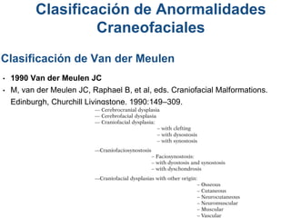 • 1990 Van der Meulen JC
• M, van der Meulen JC, Raphael B, et al, eds. Craniofacial Malformations.
Edinburgh, Churchill Livingstone, 1990:149–309.
Clasificación de Van der Meulen
Clasificación de Anormalidades
Craneofaciales
 