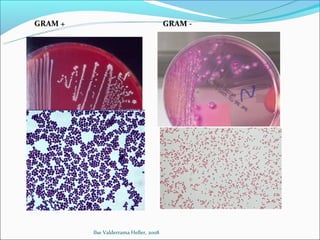 GRAM +                                  GRAM -




         Ilse Valderrama Heller, 2008
 
