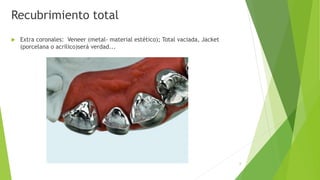 Recubrimiento total
 Extra coronales: Veneer (metal- material estético); Total vaciada, Jacket
(porcelana o acrílico)será verdad...
6
 