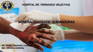 HOSPITAL DR. FERNANDO VELEZ PAIZ
GENERALIDADESDE QUEMADURAS
DR. MOISES EMANUEL CUADRA
MRI CIRUGIA GENERAL
 