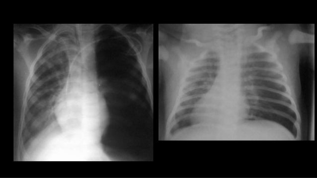 RADIOLOGIA CONVENCIONAL
⢠Herramienta anatómica
fundamental en la detección y
diagnostico de enfermedades:
⢠Tórax
⢠Abdom...