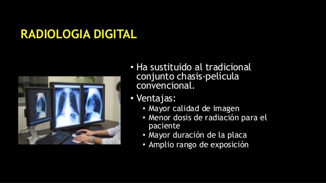 Convencional vrs Digital