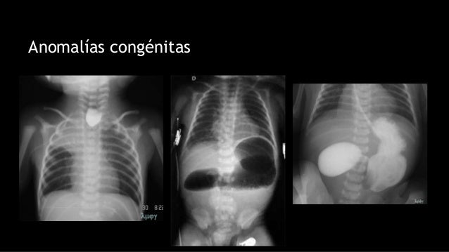 TomografÃa computarizada
Es una técnica de imagen médica
que utiliza radiación X para
obtener cortes o secciones de
objeto...