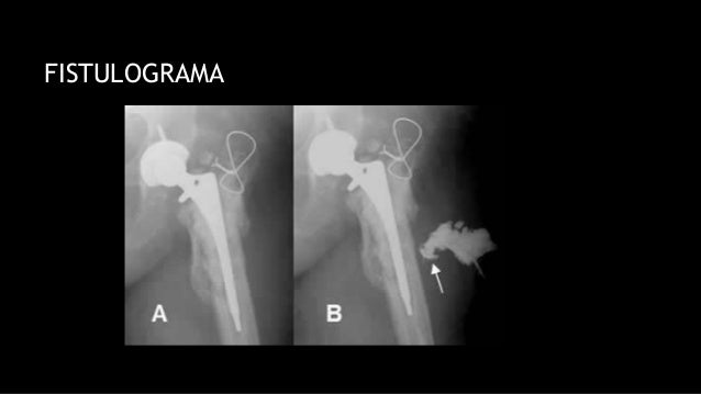 RM ï Ventajas y Desventajas