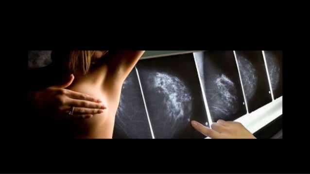 Generalidades de RadiologÃa