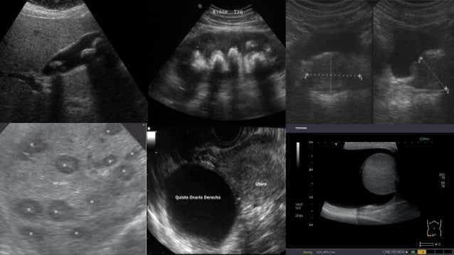 Generalidades de RadiologÃa