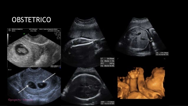 Generalidades de RadiologÃa