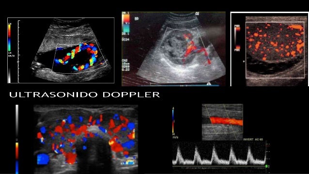 Generalidades de RadiologÃa