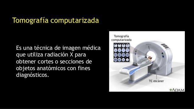 Generalidades de RadiologÃa