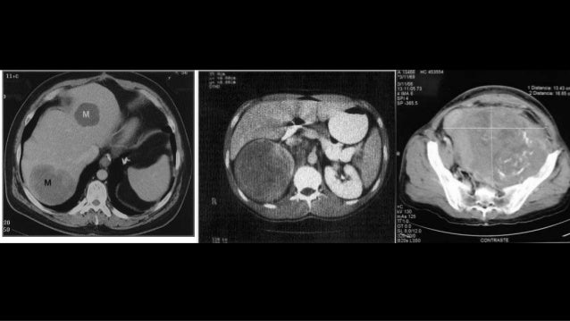 Generalidades de RadiologÃa