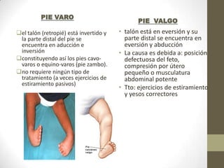 el talón (retropié) está invertido y   • talón está en eversión y su
 la parte distal del pie se               parte distal se encuentra en
 encuentra en aducción e                  eversión y abducción
 inversión                              • La causa es debida a: posición
constituyendo así los pies cavo-         defectuosa del feto,
 varos o equino-varos (pie zambo).        compresión por útero
no requiere ningún tipo de               pequeño o musculatura
 tratamiento (a veces ejercicios de       abdominal potente
 estiramiento pasivos)
                                        • Tto: ejercicios de estiramiento
                                          y yesos correctores
 