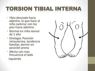 • Tibia desviada hacia
  adentro, lo que hace al
  niño caminar con los
  pies hacia adentro.
• Normal en niño menor
  de 1 año
• Etiología: Posición
  intrauterina, tendencia
  familiar, dormir en
  posición prona
• Afecta con mas
  frecuencia el lado
 izquierdo
 