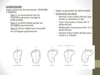 CLASIFICACION
Según potencial de correccion: CRAFORD   • Según la gravedad de deformidad:
Y GABRIEL:
                                         • clasificacion de Bleck
    Tipo 1: la estimulación de los
    músculos peroneos corrige la            • Normal: linea media del pie que
    enfermedad                                divide el calcaneo en dos
    Tipo 2: la deformidad puede ser         • Leve: linea pasa a traves del 3
    corregida pasivamente                     dedo del pie
    Tipo 3: Forma rígida que no puede       • Moderado: linea pasa entre 3 y 4
                                              dedo del pie
    ser corregida pasivamente
                                            • Severo: linea media del pie pasa
                                              entre 4 y 5 dedos
 