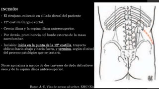 INCISIÓN
• El cirujano, colocado en el lado dorsal del paciente
• 12° costilla (larga o corta).
• Cresta ilíaca y la espina ilíaca anterosuperior.
• Por detrás, prominencia del borde externo de la masa
sacrolumbar.
• Incisión: inicia en la punta de la 12° costilla, trayecto
oblicuo hacia abajo y hacia fuera, y termina, según el nivel
del proceso patológico que se tratará.
No se aproxima a menos de dos traveses de dedo del relieve
óseo y de la espina ilíaca anterosuperior.
Baron J.-C. Vías de acceso al uréter. EMC (Elsevier SAS, Paris), Urología, 41-110,
 