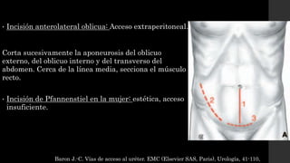 • Incisión anterolateral oblicua: Acceso extraperitoneal.
Corta sucesivamente la aponeurosis del oblicuo
externo, del oblicuo interno y del transverso del
abdomen. Cerca de la línea media, secciona el músculo
recto.
• Incisión de Pfannenstiel en la mujer: estética, acceso
insuficiente.
Baron J.-C. Vías de acceso al uréter. EMC (Elsevier SAS, Paris), Urología, 41-110,
 