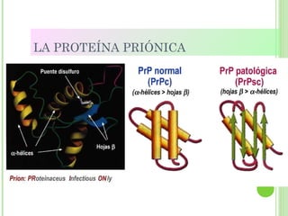 LA PROTEÍNA PRIÓNICA
 