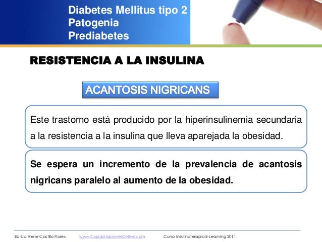 Generalidades diabetes mellitus rené castillo flores 2012 Generalidades diabetes mellitus rené castillo flores 2012