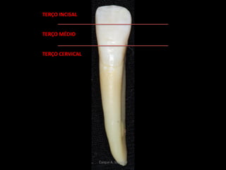 TERÇO CERVICAL
TERÇO MÉDIO
TERÇO INCISAL
Caíque A. Siqueira
 