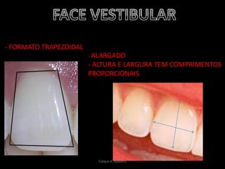 - FORMATO TRAPEZOIDAL
- ALARGADO
- ALTURA E LARGURA TEM COMPRIMENTOS
PROPORCIONAIS
Caíque A. Siqueira
 