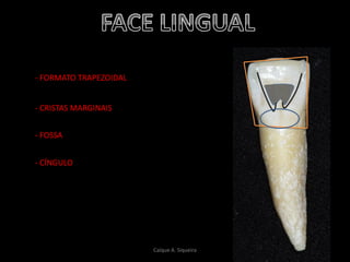 - FORMATO TRAPEZOIDAL
- CRISTAS MARGINAIS
- FOSSA
- CÍNGULO
Caíque A. Siqueira
 